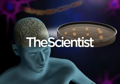 Capturing Brain Complexity in Assembloids&nbsp;